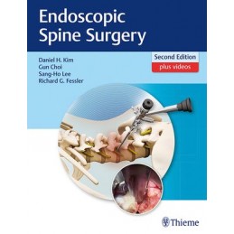 Endoscopic Spine Surgery