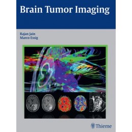 Brain Tumor Imaging