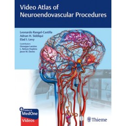 Video Atlas of Neuroendovascular Procedures