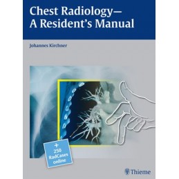 Chest Radiology: A...