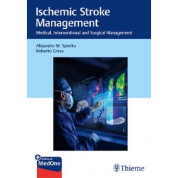 Ischemic Stroke Management:...