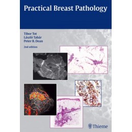 Practical Breast Pathology