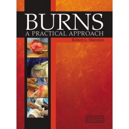 Burns: A Practical Approach...