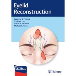 Eyelid Reconstruction