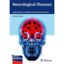 Neurological Diseases:...