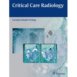 Critical Care Radiology