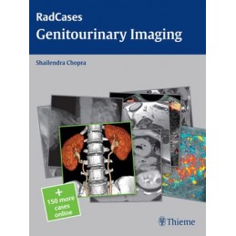 Radcases Genitourinary Imaging