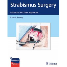 Strabismus Surgery:...