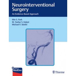 Neurointerventional...