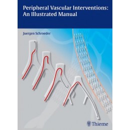 Peripheral Vascular...