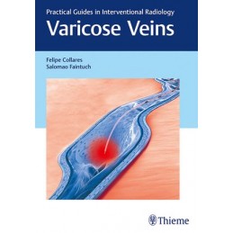 Varicose Veins: Practical...