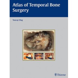 Atlas of Temporal Bone Surgery