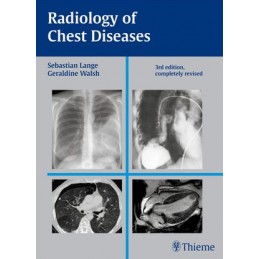 Radiology of Chest Diseases