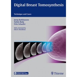 Digital Breast...