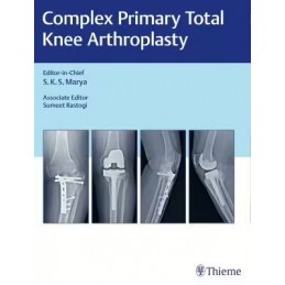 Complex Primary Total Knee...