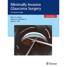 Minimally Invasive Glaucoma...