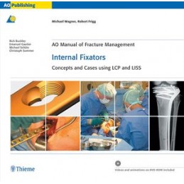 AO Manual of Fracture...