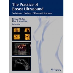 The Practice of Breast Ultrasound: Techniques, Findings, Differential Diagnosis