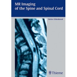 MR Imaging of the Spine and...