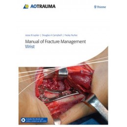 Manual of Fracture...