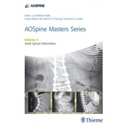 AOSpine Master Series, Vol....