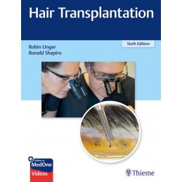 Hair Transplantation