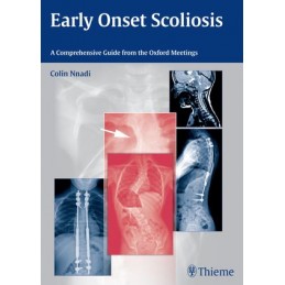 Early Onset Scoliosis: A...