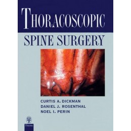 Thoracoscopic Spine Surgery