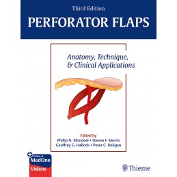 Perforator Flaps: Anatomy,...