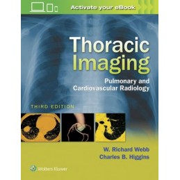 Thoracic Imaging: Pulmonary and Cardiovascular Radiology