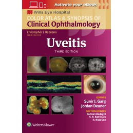 Uveitis