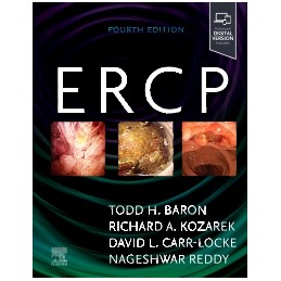 ERCP