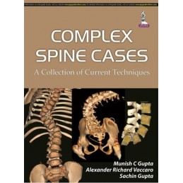 Complex Spine Cases: A...