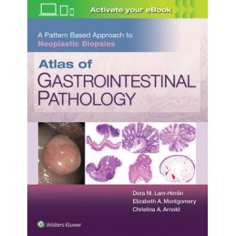 Atlas of Gastrointestinal Pathology: A Pattern Based Approach to Neoplastic Biopsies