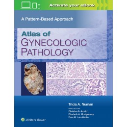 Atlas of Gynecologic Pathology: A Pattern-Based Approach: Print + digital version with Multimedia