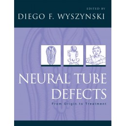 Neural Tube Defects