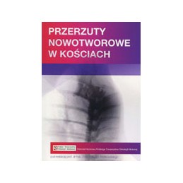 Przerzuty nowotworowe w...