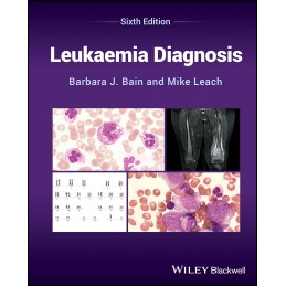 Leukaemia Diagnosis