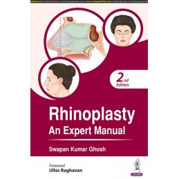 Rhinoplasty: An Expert Manual