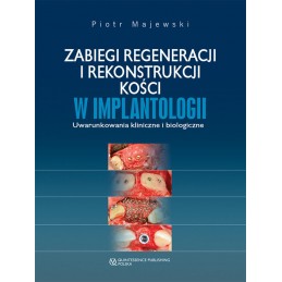 Zabiegi regeneracji i rekonstrukcji kości w implantologii