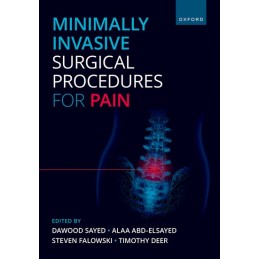 Minimally Invasive Surgical Procedures for Pain