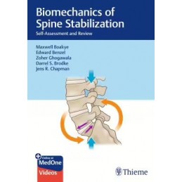 Biomechanics of Spine Stabilization: Self-Assessment and Review