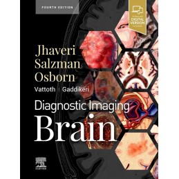 Diagnostic Imaging: Brain