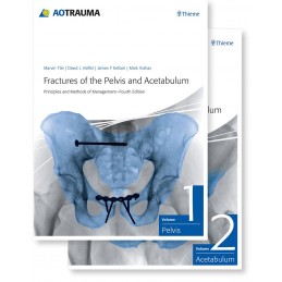 Fractures of the Pelvis and Acetabulum (AO): Principles and Methods of Management