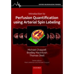 Introduction to Perfusion...