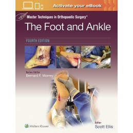 Master Techniques in Orthopaedic Surgery: The Foot and Ankle: Print + digital version with Multimedia