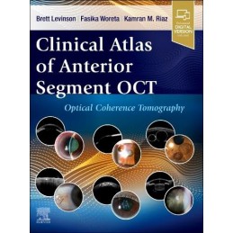 Clinical Atlas of Anterior Segment OCT: Optical Coherence Tomography