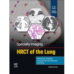 Specialty Imaging: HRCT of the Lung