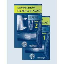 Kompendium leczenia złamań...