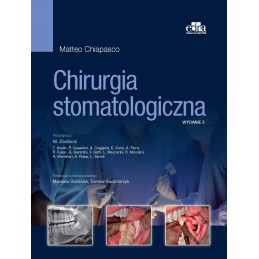 Chirurgia stomatologiczna